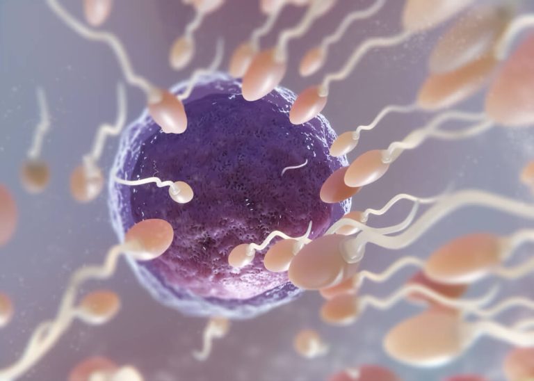 IVF คือ